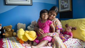 جراحة ناجحة لطفلة بنغالية مولودة بثلاثة أرجل 