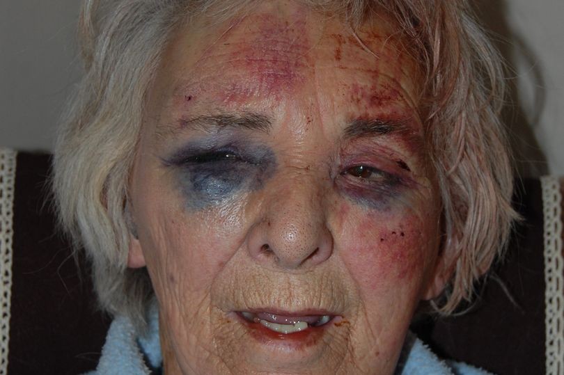 التعدي بالضرب على سيدة عجوز عند باب منزلها جنوب لندن 